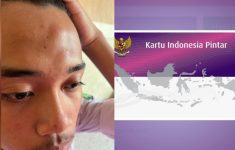 Kronologi Siswa SMP Dianiaya Anak Kepsek di Bekasi, Korban Babak Belur Usai Kritik Potongan Dana PIP