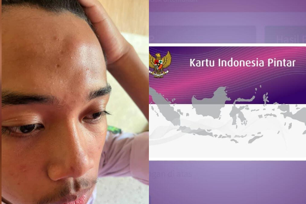 Kronologi Siswa SMP Dianiaya Anak Kepsek di Bekasi, Korban Babak Belur Usai Kritik Potongan Dana PIP