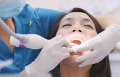 Syarat Scaling Gigi Gratis Pakai BPJS Kesehatan, Simak Prosedurnya