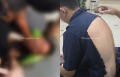 ASN Dikeroyok Usai Adu Mulut dengan Mantan Istri di Mall Jakut, Korban Alami Lebam Sekujur Tubuh