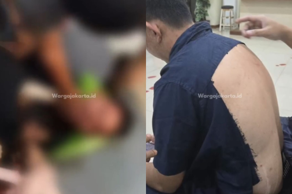 ASN Dikeroyok Usai Adu Mulut dengan Mantan Istri di Mall Jakut, Korban Alami Lebam Sekujur Tubuh