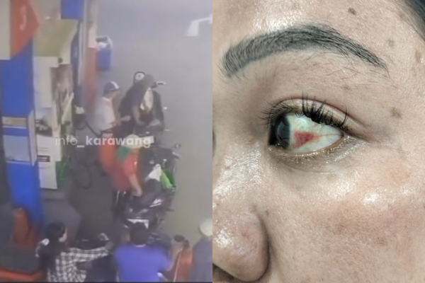 Wanita Dianiaya Saat Antre SPBU di Karawang, Pelaku Tendang Motor Diduga Tersulut Emosi