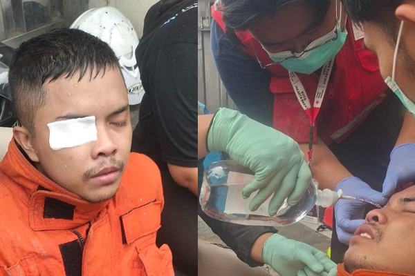 Mata Petugas Damkar Cedera Gegara Lemparan Sambal Saat Kebakaran Tambora, Awalnya Niat Padamkan Api