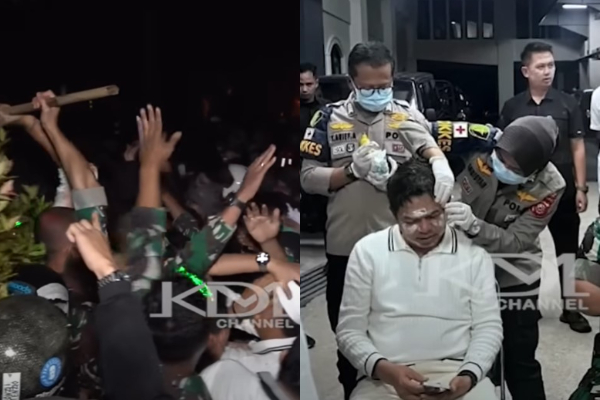 Gubernur Jawa Barat Dedi Mulyadi Temui Pendemo Bandung, Pelipis Jadi Korban: Jangan Menyentuh Gedung Sate