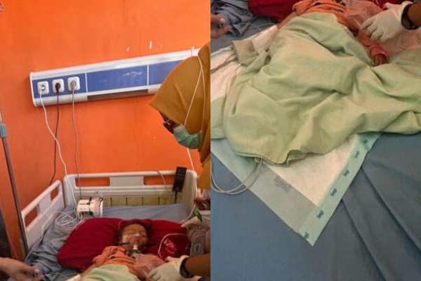 Kakak Beradik Mengeluarkan Cacing dari Mulut di Bengkulu, Begini Kondisinya Sekarang!