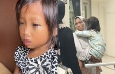 Guru Bantah Anak SD di Palembang Dianiaya, Sebut Mata Lebam Gegara Main HP