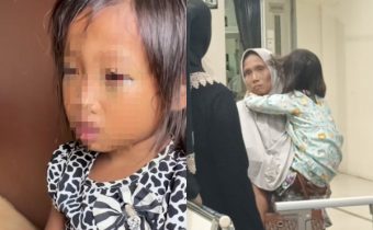 Guru Bantah Anak SD di Palembang Dianiaya, Sebut Mata Lebam Gegara Main HP