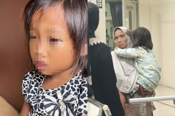 Guru Bantah Anak SD di Palembang Dianiaya, Sebut Mata Lebam Gegara Main HP