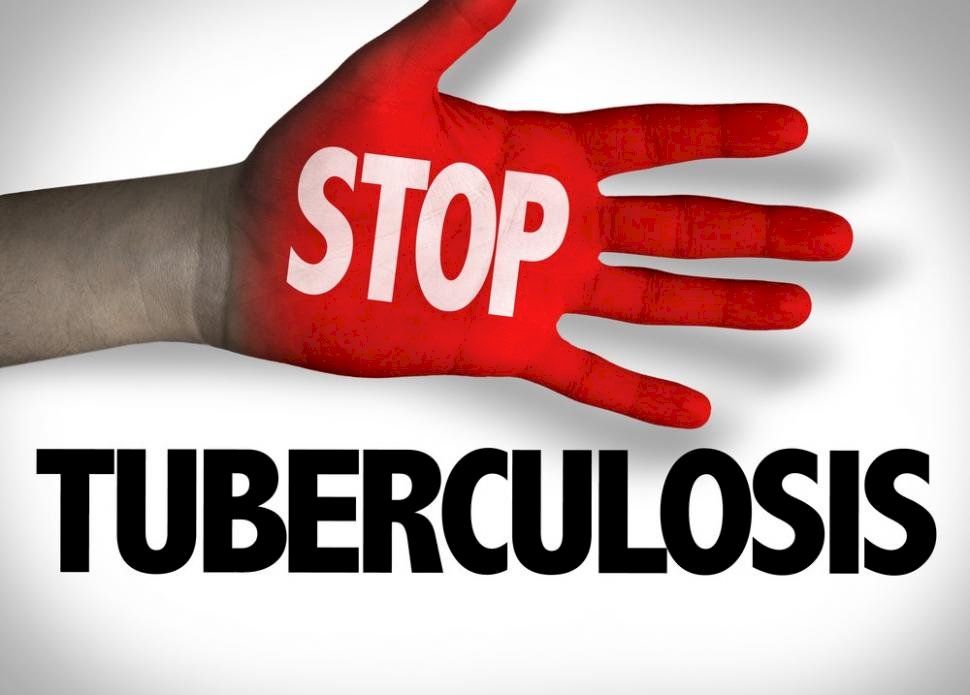 Ilustrasi stop tuberculosis