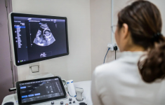 Jadwal USG yang Tepat