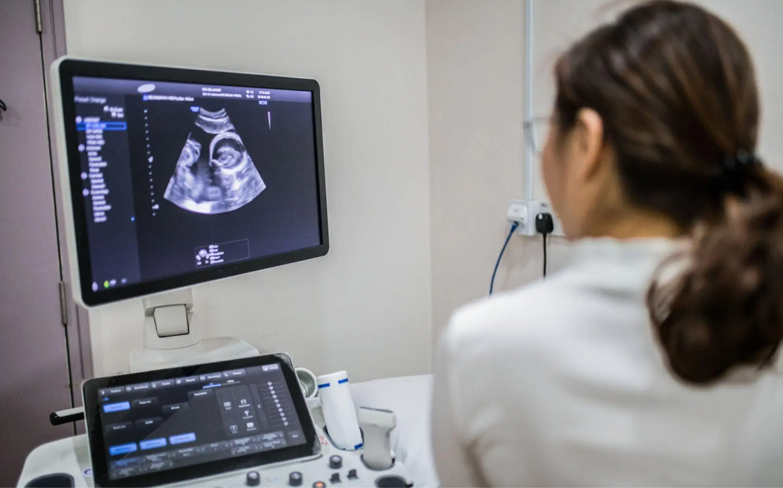 Jadwal USG yang Tepat