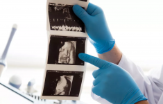 Tahap Perkembangan Janin 1-9 Bulan dalam Kandungan