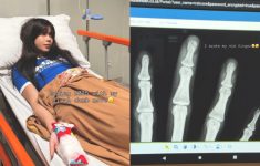 Sabrina Chairunnisa Alami Retak di Jari Tengah Saat Tutup Pintu Garasi: Dear 2025, Ampun!