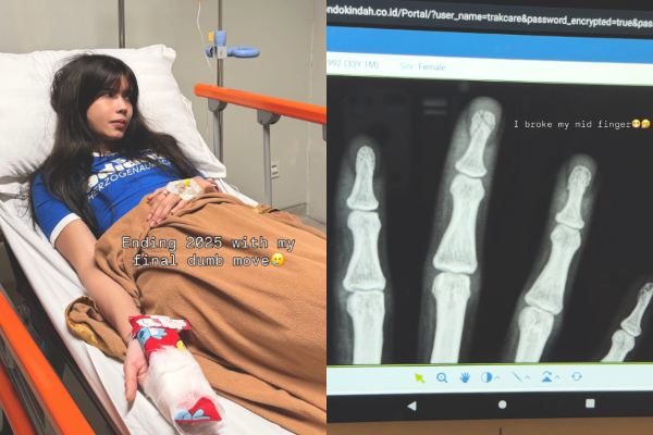 Sabrina Chairunnisa Alami Retak di Jari Tengah Saat Tutup Pintu Garasi: Dear 2025, Ampun!