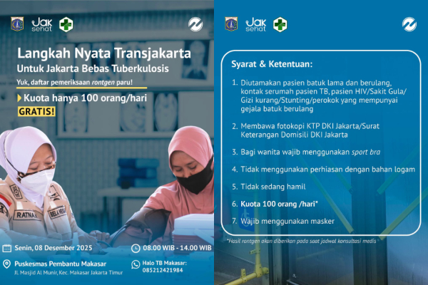 Jadwal Cek Pemeriksaan Rontgen Paru GRATIS di Jakarta, Khusus 100 Orang per Hari!