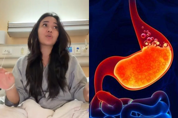 Perbedaan Nyeri Ulu Hati Akibat GERD dan Penyakit Jantung, Yuk Kenali Gejalanya!