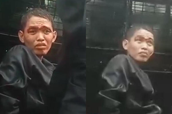 Pembunuh Anak Politisi PKS Idap Penyakit Kanker Stadium 3: Kemo Tiap Minggu di RS