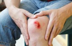 Apakah Keluar Darah Membatalkan Puasa? dari Luka hingga Mimisan, Ini Penjelasan Hukumnya!