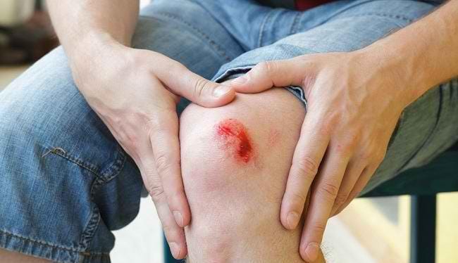 Apakah Keluar Darah Membatalkan Puasa? dari Luka hingga Mimisan, Ini Penjelasan Hukumnya!