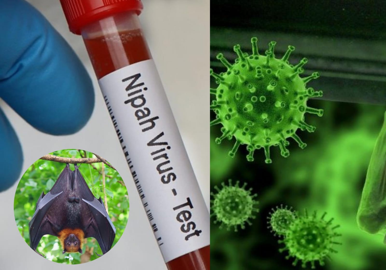 Heboh Virus Nipah di India, Apa Itu Virus Nipah? Kenali Gejala, dan Cara Menceganya!