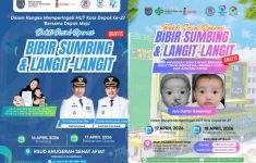 Gratis! Cara Daftar Operasi Bibir Sumbing di Depok April 2026, Catat Tanggalnya