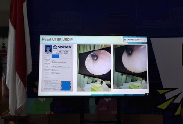 Viral Kecurangan UTBK 2026 di Undip