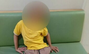 Bocah Down Syndrome di Surabaya Meninggal